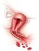 Dysfunkční děložní krvácení